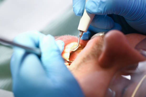 Best Emergency Root Canal Treatment in Leitchfield, KY